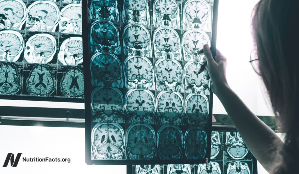 A Persistent Pesticide Is Linked to Alzheimer’s Risk