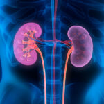 Phase 3 Data Could Make Roche Drug a Contender to Treat Rare Kidney Disease`